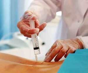 La aplicación de ozonoterapia dirigida a deportistas de alto rendimiento.